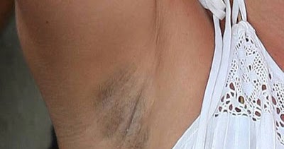 Hilangkan Ketiak Hitam dengan Bahan Alami